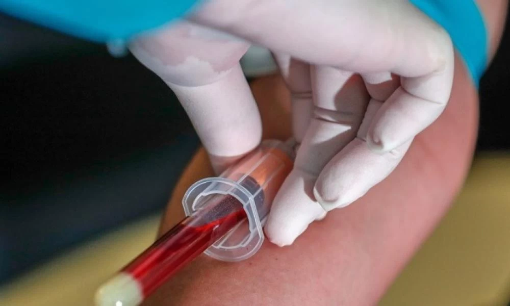 Κορονοϊός: Αναφορές αλλεργικών αντιδράσεων στα mRNA εμβόλια στις ΗΠΑ